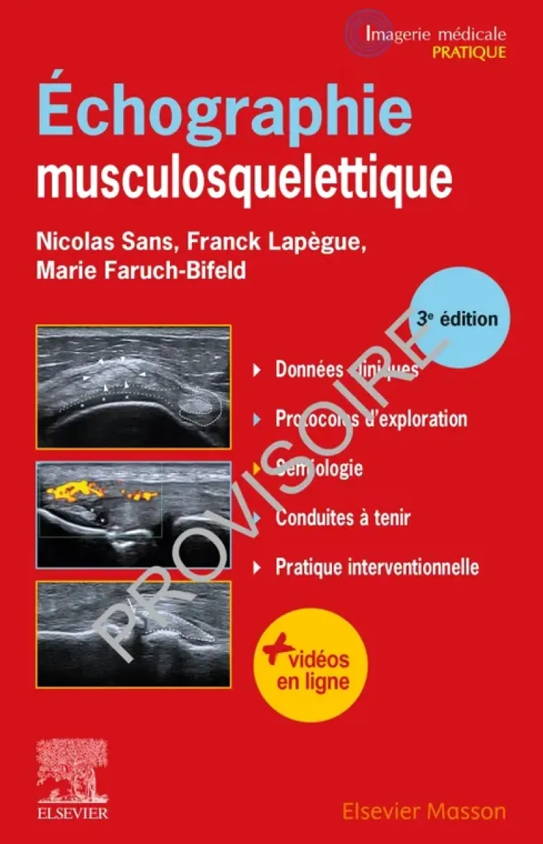 Echographie musculosquelettique