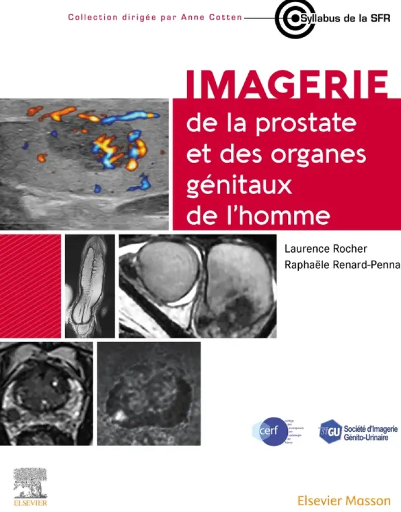 Imagerie de la prostate et des organes génitaux de l'homme