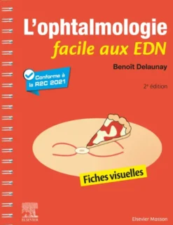 L'ophtalmologie facile aux EDN
